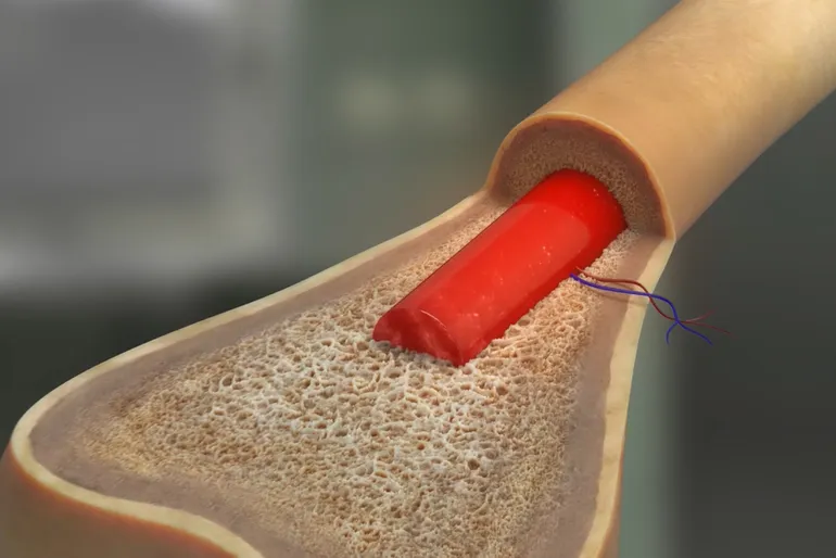 A Closer Look at CLL