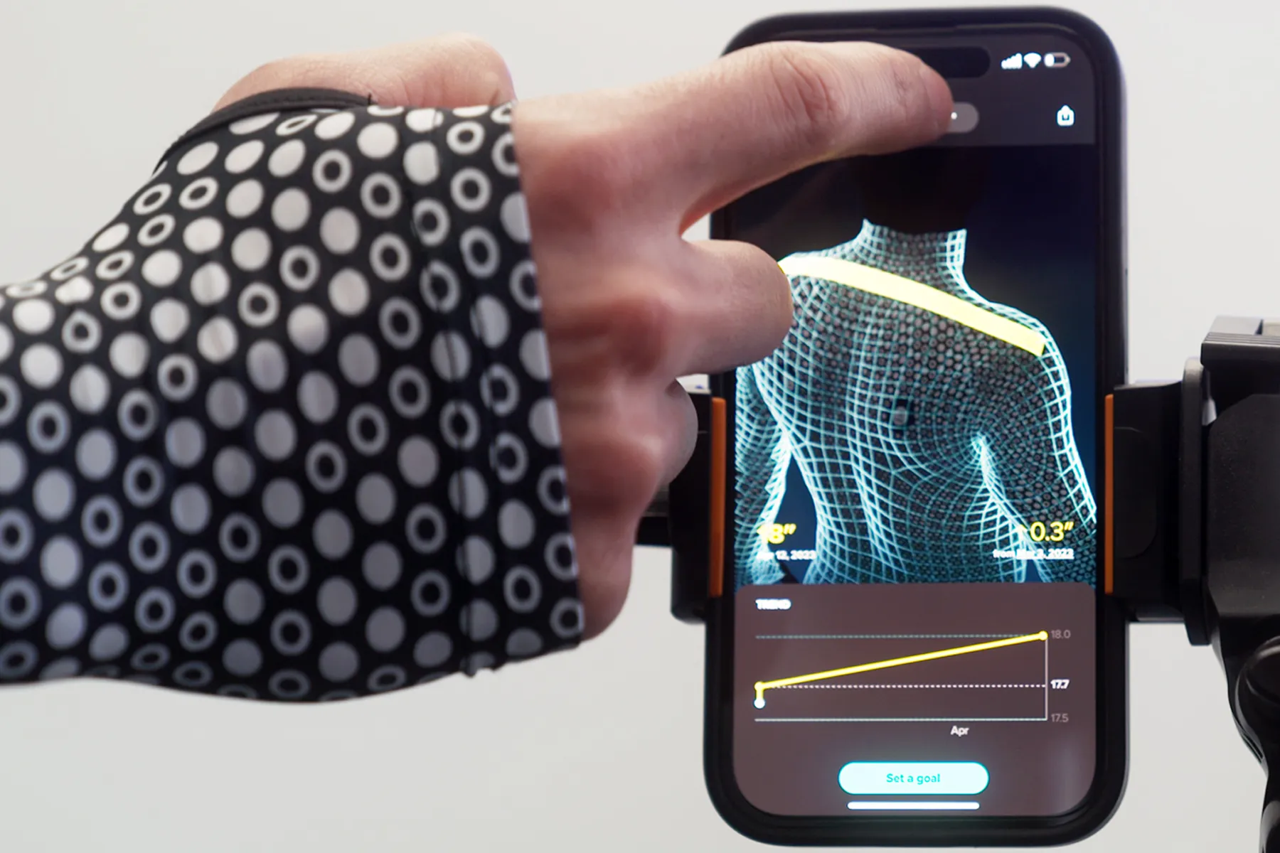 Physical Therapy Tools Enable Data-Driven Wellness