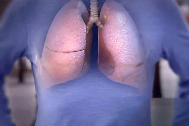 E-Asthma Explained