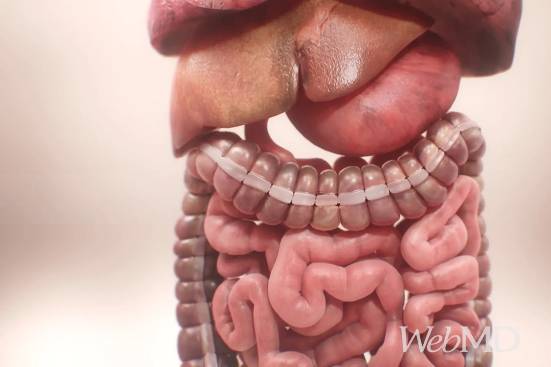 How It Affects Your Colon