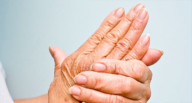 What Is a Ganglion Cyst?