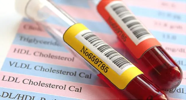 Understanding Anemia