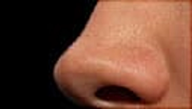 Decreased Sense of Smell: COVID-19 and other infections. Decreased Sense of Smell: COVID-19 and other infections.