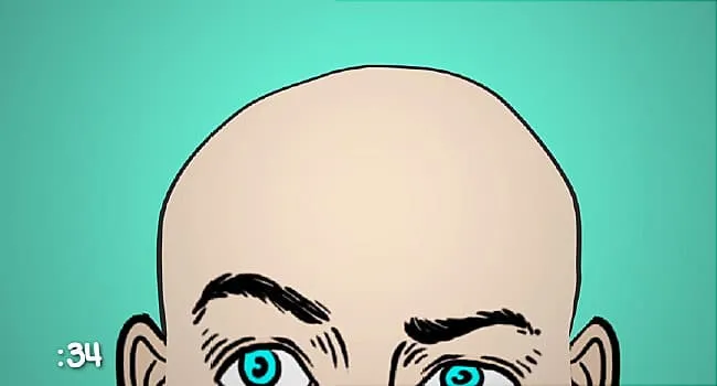 Why Men Go Bald