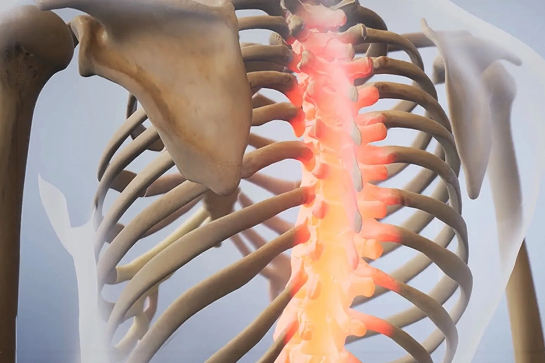 Conditions  Related to Psoriatic Arthritis