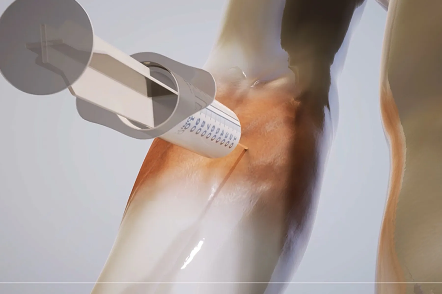 How Injections and Infusions Work
