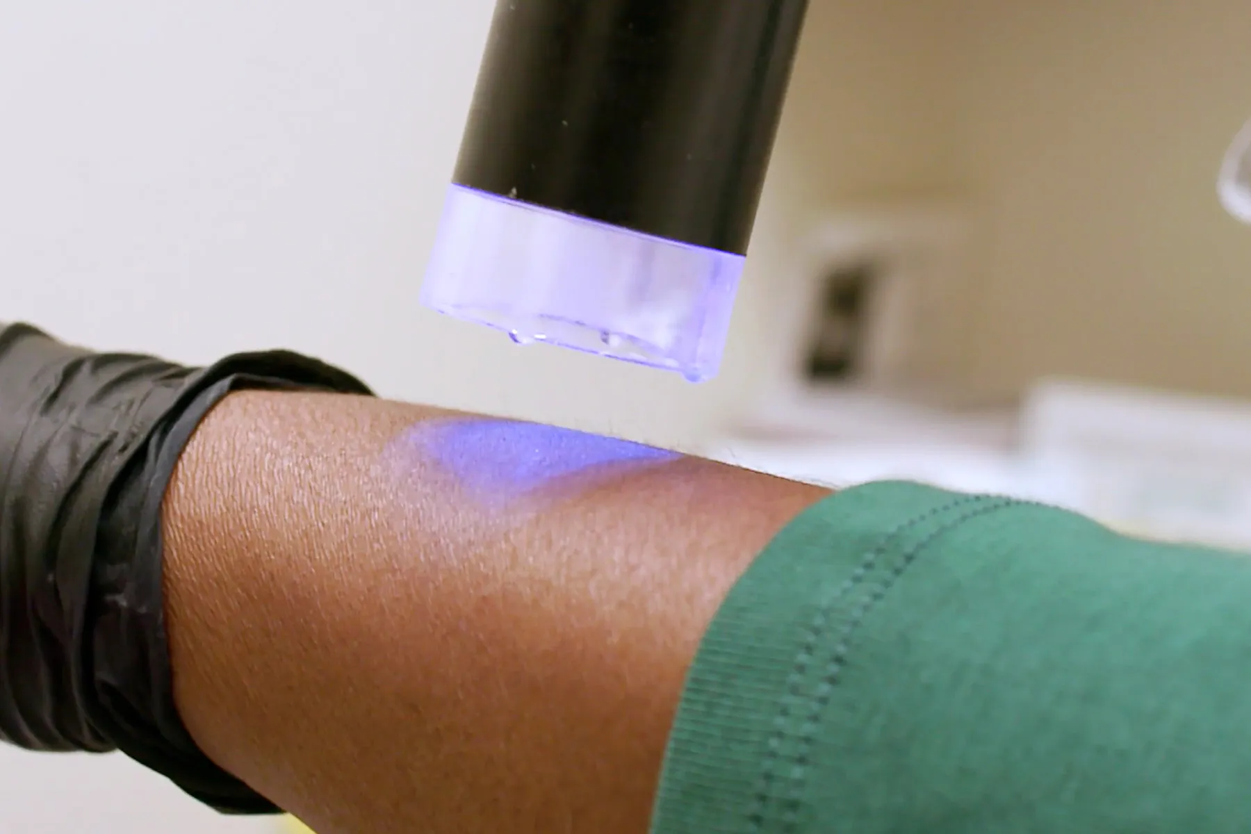 A Dermatologist’s Insight