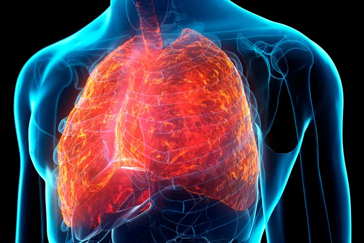 Learn More About COPD