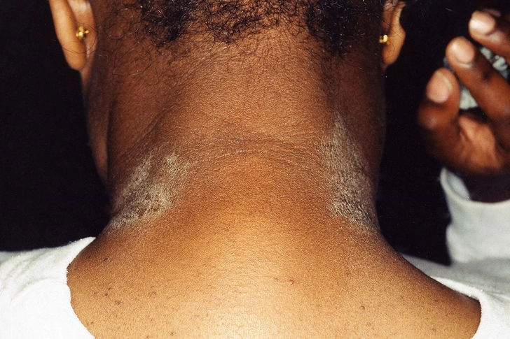 No. 5: Itchy Skin