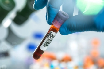 Your Blood Test Results Improve