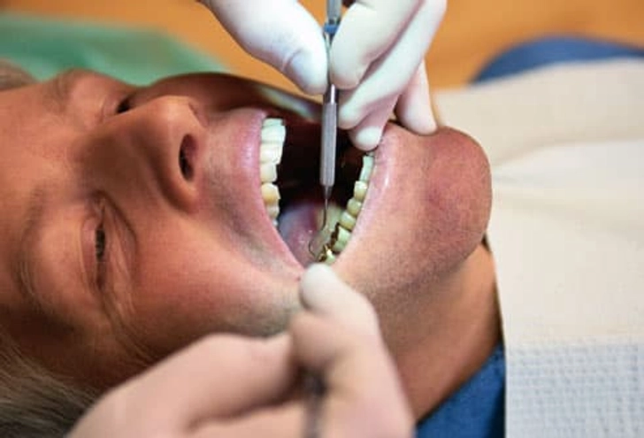 Tooth Whitening and Dental Work Tooth Whitening and Dental Work