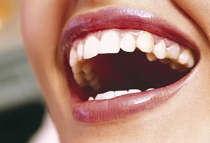Want Brighter, Whiter Teeth? Want Brighter, Whiter Teeth?