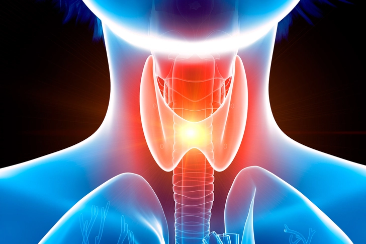 Hypothyroidism