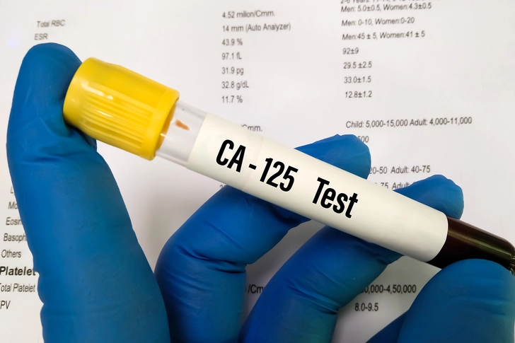 7. CA-125 Is not a Magic Marker