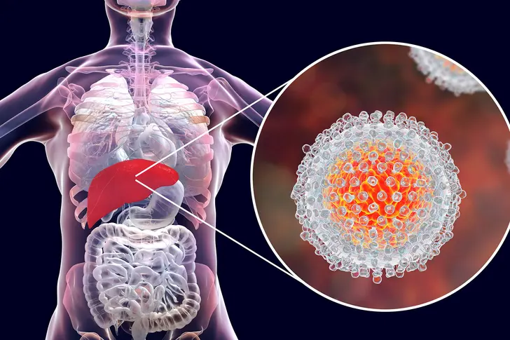 Why You Need to Look Out for Hepatitis C Signs