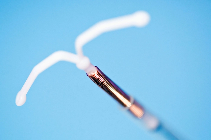 Intrauterine Devices (IUDs)