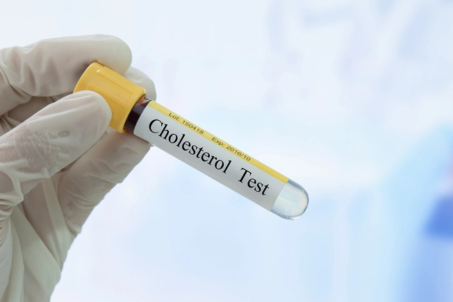 Sağlıksız Yağları Azaltın