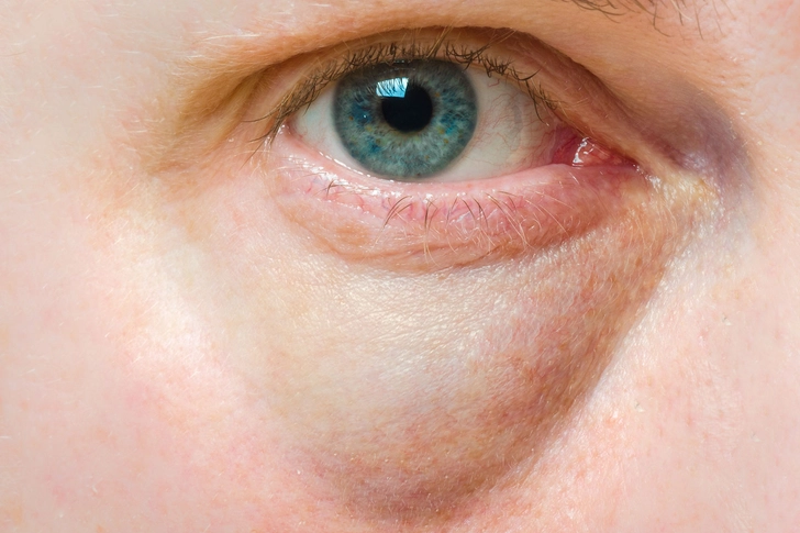 Causes Skin Outbreaks