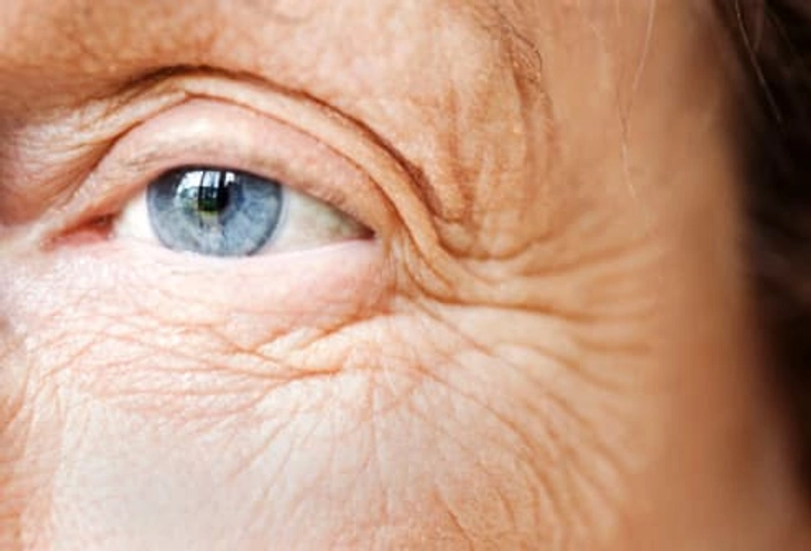 Harm: Aging Harm: Aging