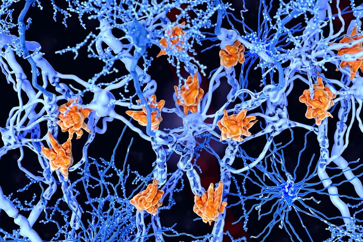 Tips From Celebrities with Multiple Sclerosis