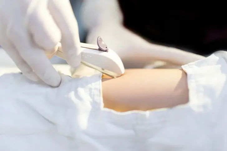Understanding Birth Control Implants