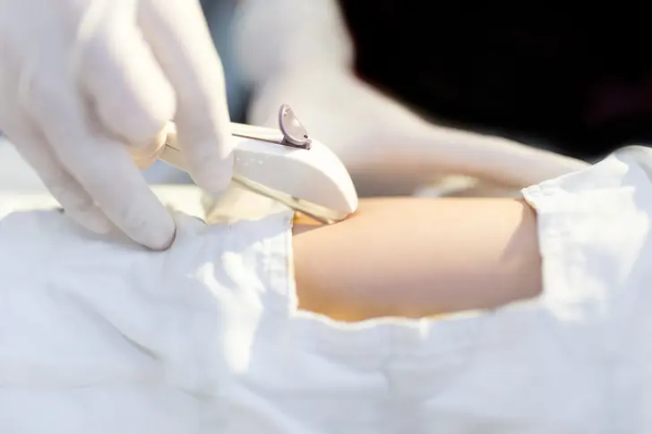 Understanding Birth Control Implants Understanding Birth Control Implants