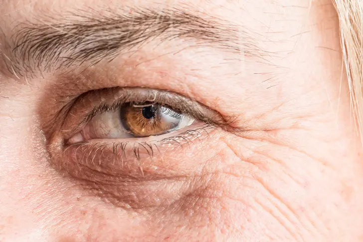 Understanding Diabetic Macular Edema Understanding Diabetic Macular Edema