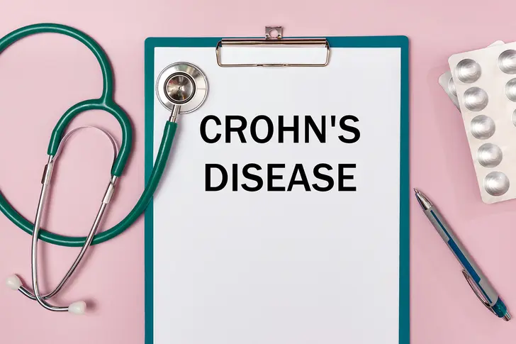 Understanding Crohn's Disease Understanding Crohn's Disease