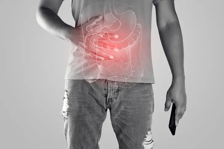 Understanding Crohn's Disease