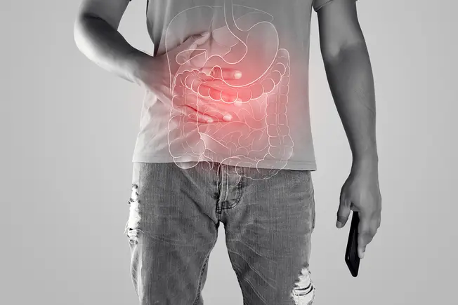 Understanding Crohn's Disease Understanding Crohn's Disease