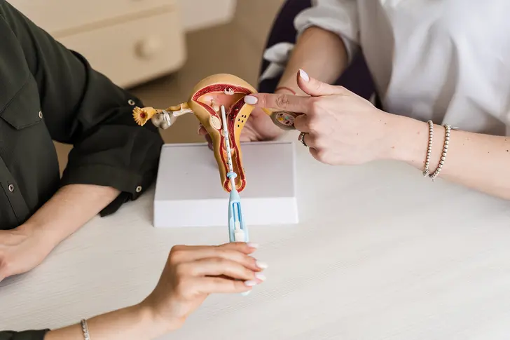 Understanding IUDs