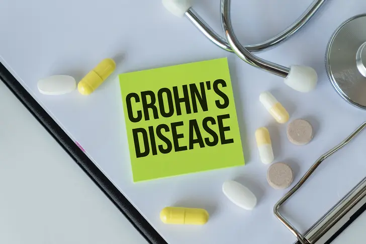 Crohn's Disease: What Is Remission? Crohn's Disease: What Is Remission?