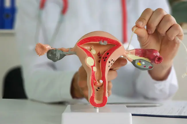 Understanding Tubal Ligation