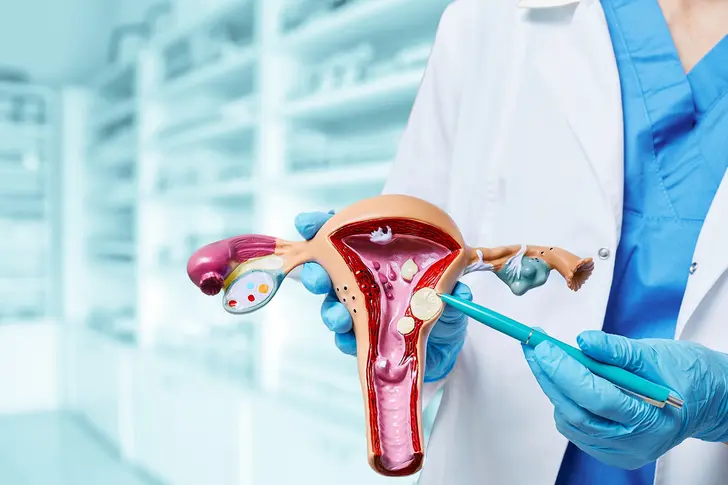 Understanding Uterine Fibroids Understanding Uterine Fibroids