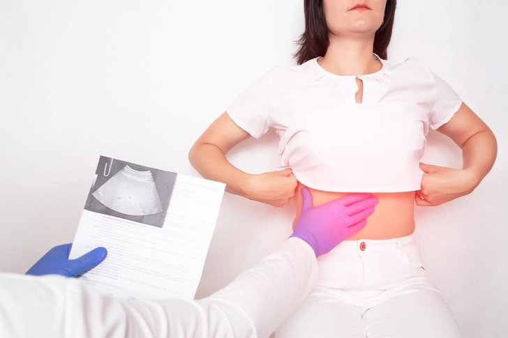 PCOS and Liver Health