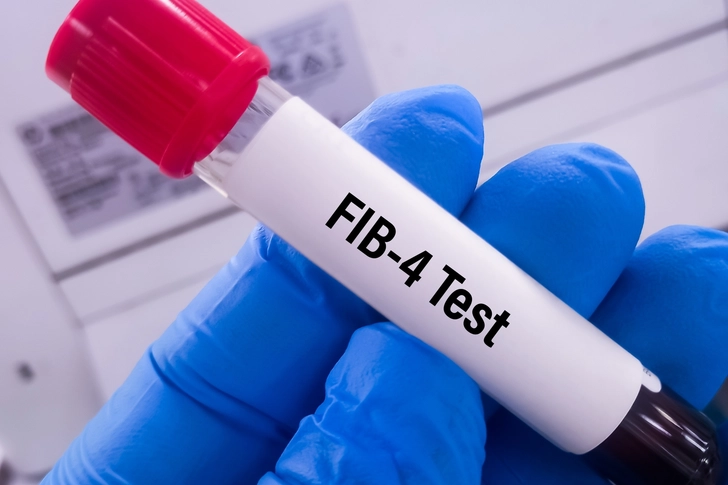 Testing and Diagnosis