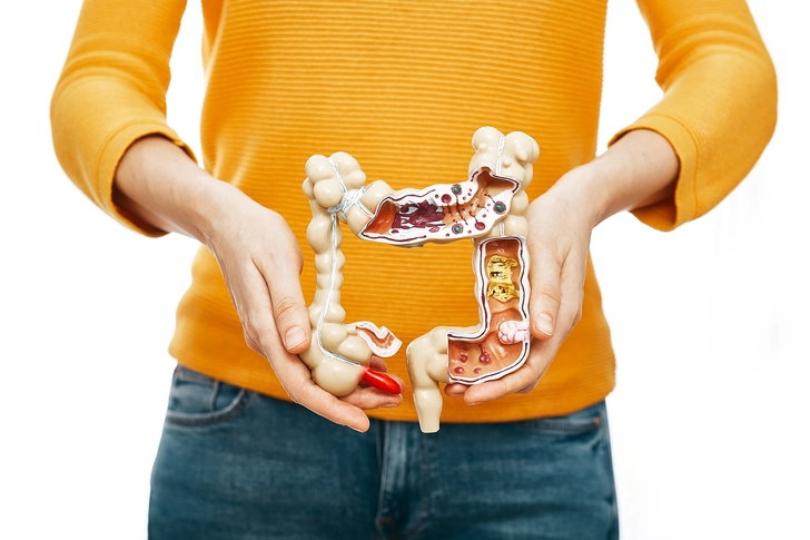 Types of Crohn's Disease Types of Crohn's Disease