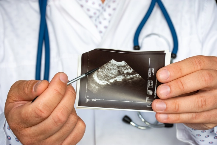 Tumor Size Matters Tumor Size Matters