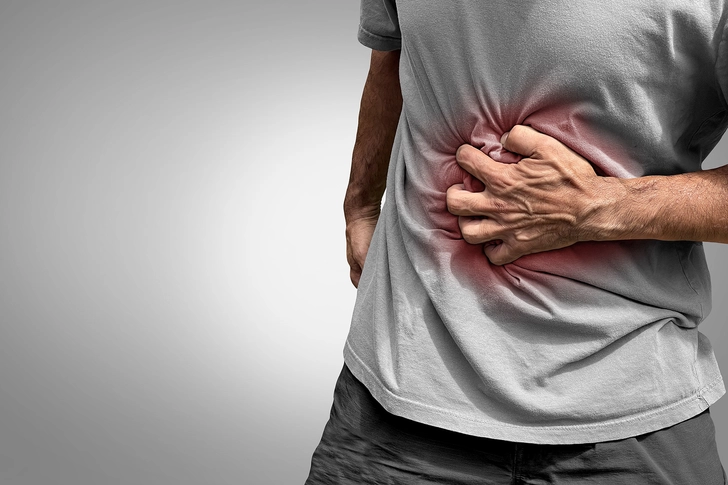 Most Common: Ileocolitis Most Common: Ileocolitis