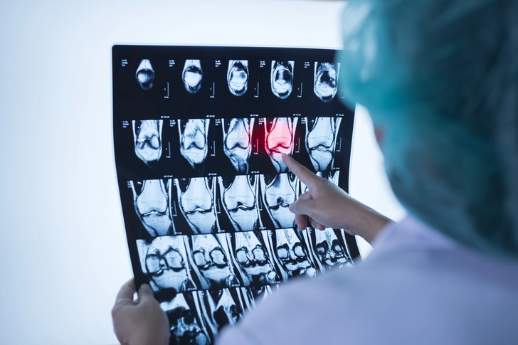 How Doctors Diagnose Joint Problems