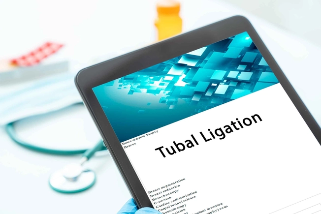 Pros of Tubal Ligation