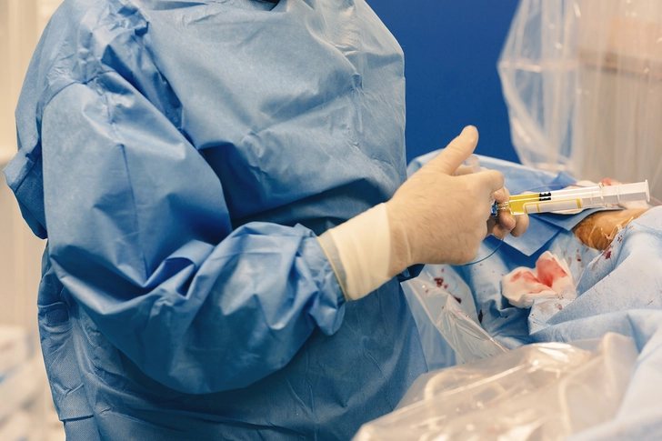 Uterine Artery Embolization
