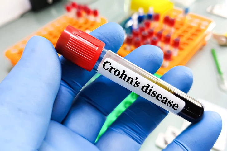 How Liver Damage Is Diagnosed