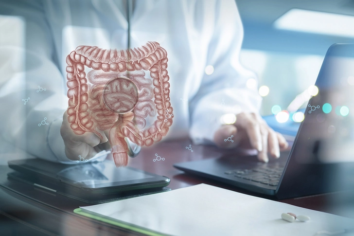 Causes of Crohn's Disease Causes of Crohn's Disease