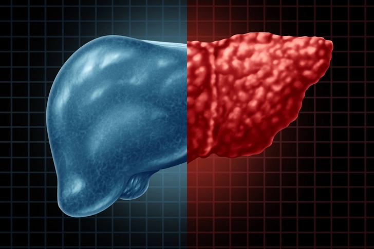 Why Women Should Pay Attention