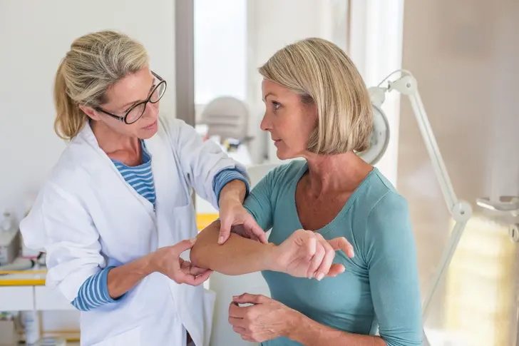 Aging With Psoriasis: What to Expect