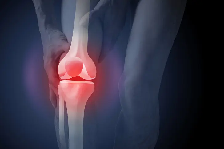 What Makes Psoriatic Arthritis Worse?