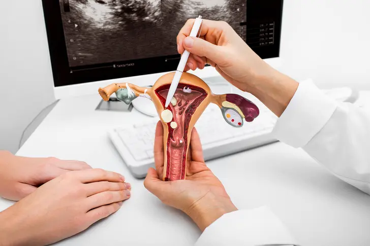 What Is Uterine Cancer?
