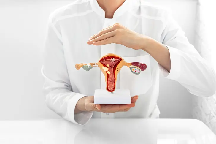Endometriosis vs. Endometrial Cancer