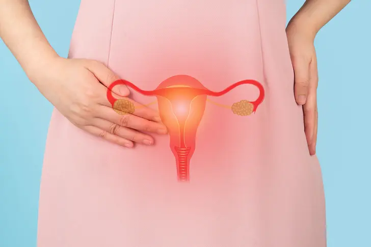 What Are the Symptoms of Endometrial Cancer?